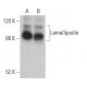 Lamellipodin Antibody (A-8) - Western Blotting - Image 364064