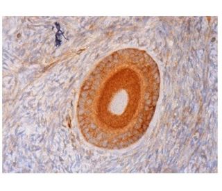 Lamellipodin Antibody (H-5) - Immunohistochemistry - Image 293713 