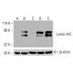 Lamin A/C 抗体 (2A1):sc-517580。未经处理的 HeLa (A)、经化学处理的 HeLa (B)、未经处理的 HCT-116 (C) 及经化学处理的 HCT-116 (D, E) 全细胞裂解液中Lamin A/C表达的Western blot分析。所用检测试剂:m-IgG2b BP-HRP:sc-542741。β-肌动蛋白 (C4):sc-47778 用作内参。所用检测试剂:m-IgG Fc BP-HRP:sc-525409。 Lamin A/C Antibody (2A1) - Western Blotting - Image 416467