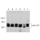 Lamin A/C Antibody (4C11) - Western Blotting - Image 386835 