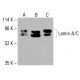 Lamin A/C 抗体 (4C11):sc -517579。HeLa(A)、K-562(B)和HCT-116(C)全细胞裂解液中Lamin A/C表达的Western blot分析。所用检测试剂:m-IgG Fc BP-HRP:sc-525409。 Lamin A/C Antibody (4C11) - Western Blotting - Image 416468