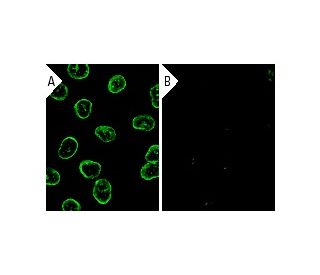Lamin A/C siRNA (h): sc-35776. Immunofluorescence staining of methanol-fixed, control HeLa (A) and Lamin A/C siRNA silence 