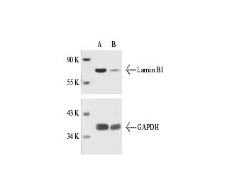 Lamin B1 siRNA (h): sc-29386. Western blot analysis of Lamin B1 expression in non-transfected control (A) and Lamin B1 siR 