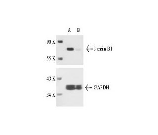 Lamin B1 siRNA (m): sc-35779. Western blot analysis of Lamin B1 expression in non-transfected control (A) and Lamin B1 siR 
