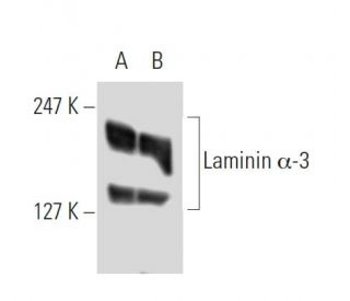 Laminin-5 Antibody (P3E4) - Western Blotting - Image 9052 