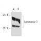 Laminin-5 Antibody (P3E4) - Western Blotting - Image 9052 