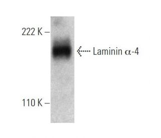 Laminin α-4 Antibody (6C3) - Western Blotting - Image 366686SAM Transcription Activation: SAM system utilizing dCas9-VP64, MS2-P65-HSF1, and sgRNA for precise gene transcription activation.