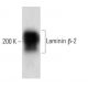 Laminin β-2 Antibody (22) - Western Blotting - Image 60344