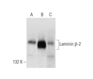 Laminin &beta;-2 Antibody (22) - Western Blotting - Image 136336 