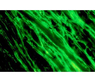 Laminin &gamma;-1 Antibody (A5) - Immunofluorescence - Image 12156 