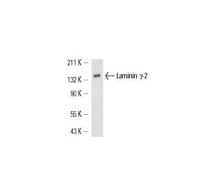 Laminin &gamma;-2 Antibody (E-1) - Western Blotting - Image 13975