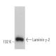 Laminin γ-2 Antibody (H-8) - Western Blotting - Image 362054 