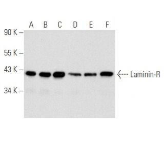 Laminin-R Antibody (33) - Western Blotting - Image 356623