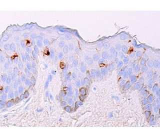 Langerin Antibody (H-4) - Immunohistochemistry - Image 378079 