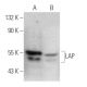 LAP Antibody (J-17A) - Western Blotting - Image 368257