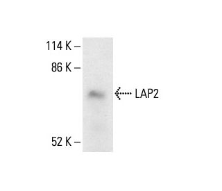 LAP2 Antibody (3A3) - Western Blotting - Image 411212Each CRISPR/Cas9 Knockout (KO) Plasmid product consists of a pool of 3 plasmids designed to ensure identification and cleavage of a specific gene for maximum knockout efficiency. Each plasmid encodes a unique 20 nt sequence derived from the GeCKO (v2) library.