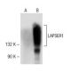 LAPSER1 Antibody (F-11) - Western Blotting - Image 141560 