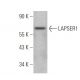 LAPSER1 Antibody (F-11) - Western Blotting - Image 372506