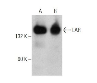 LAR Antibody (7) - Western Blotting - Image 386124 
