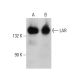 LAR Antibody (7) - Western Blotting - Image 386124 