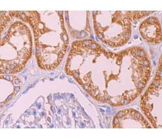 LARG Antibody (H-3) - Immunohistochemistry - Image 374082 