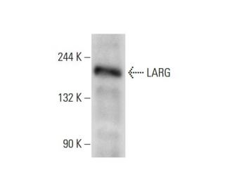 LARG Antibody (H-3) - Western Blotting - Image 72438Each CRISPR/Cas9 Knockout (KO) Plasmid product consists of a pool of 3 plasmids designed to ensure identification and cleavage of a specific gene for maximum knockout efficiency. Each plasmid encodes a unique 20 nt sequence derived from the GeCKO (v2) library.