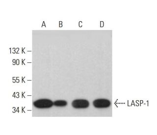 LASP-1 Antibody (B-3) - Western Blotting - Image 382358 