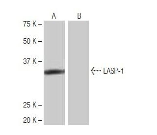 LASP-1 Antibody (KK-M25) - Western Blotting - Image 64990