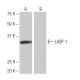 LASP-1 Antibody (KK-M25) - Western Blotting - Image 64990