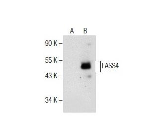 LASS4 Antibody (D-6) - Western Blotting - Image 155737 