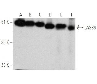 LASS6 Antibody (L-18) - Western Blotting - Image 368265 
