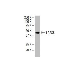 LASS6 Antibody (L-18) - Western Blotting - Image 33927