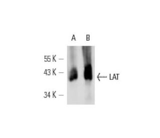 LAT Antibody (LAT-01) - Western Blotting - Image 12672