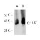 LAT Antibody (LAT-01) - Western Blotting - Image 12672
