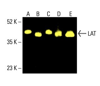 LAT Antibody (11B.12) - Western Blotting - Image 411107