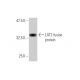 LAT2 Antibody (3F10) - Western Blotting - Image 349542