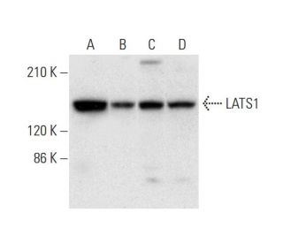 LATS1 Antibody (G-12) - Western Blotting - Image 305786