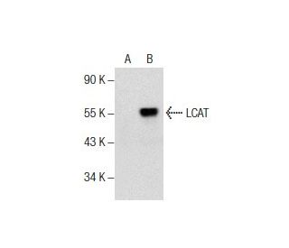 LCAT Antibody (D-2) - Western Blotting - Image 157825