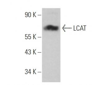 LCAT Antibody (D-3) - Western Blotting - Image 359237 