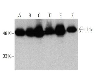 Lck Antibody (3A5) - Western Blotting - Image 384026 
