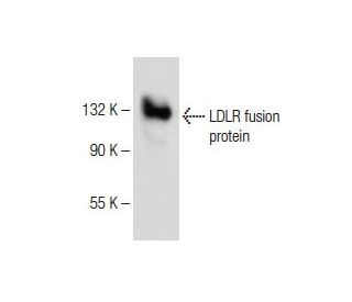 LDLR Antibody (B-10) - Western Blotting - Image 150572 
