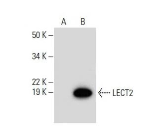 LECT2 Antibody (B-6) - Western Blotting - Image 300573
