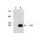 LECT2 Antibody (B-6) - Western Blotting - Image 300573