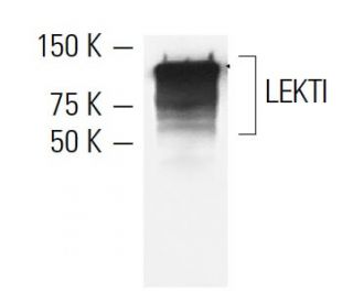 LEKTI Antibody (1C11G6) - Western Blotting - Image 9212 