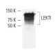 LEKTI Antibody (1C11G6) - Western Blotting - Image 9212 