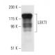 LEKTI Antibody (1C11G6) - Western Blotting - Image 10479