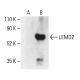 LEMD2 Antibody (H-12) - Western Blotting - Image 404068