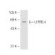 LEPREL4 Antibody (FR-1) - Western Blotting - Image 84058