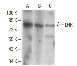 LHR Antibody (8G9A2) - Western Blotting - Image 358343The Double Nickase Plasmid features a U6 promoter for sgRNA expression, a 20 nt targeting sequence, and a gRNA scaffold to guide Cas9n. It includes a CBh promoter for Cas9n (D10A) and puromycin resistance, GFP for transfection verification, and nuclear localization signals (NLS). The 2A peptide allows co-expression of Cas9n and Puro from a single promoter, enabling precise genome editing with reduced off-target effects.