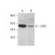 LHX2 Antibody (6G2) - Western Blotting - Image 376454
